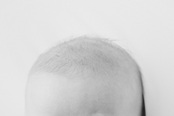 xOliver 3mth-16