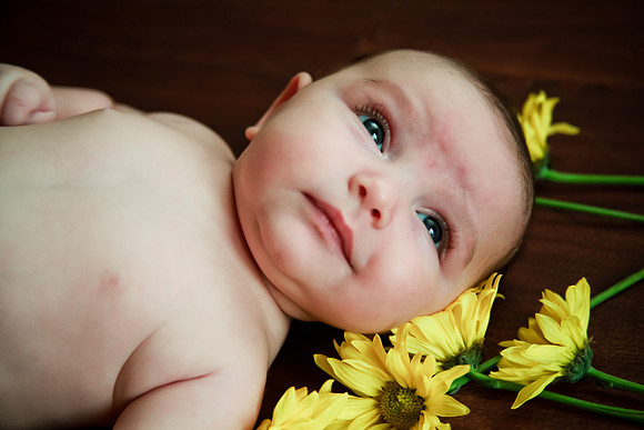 Nora 2mth-21